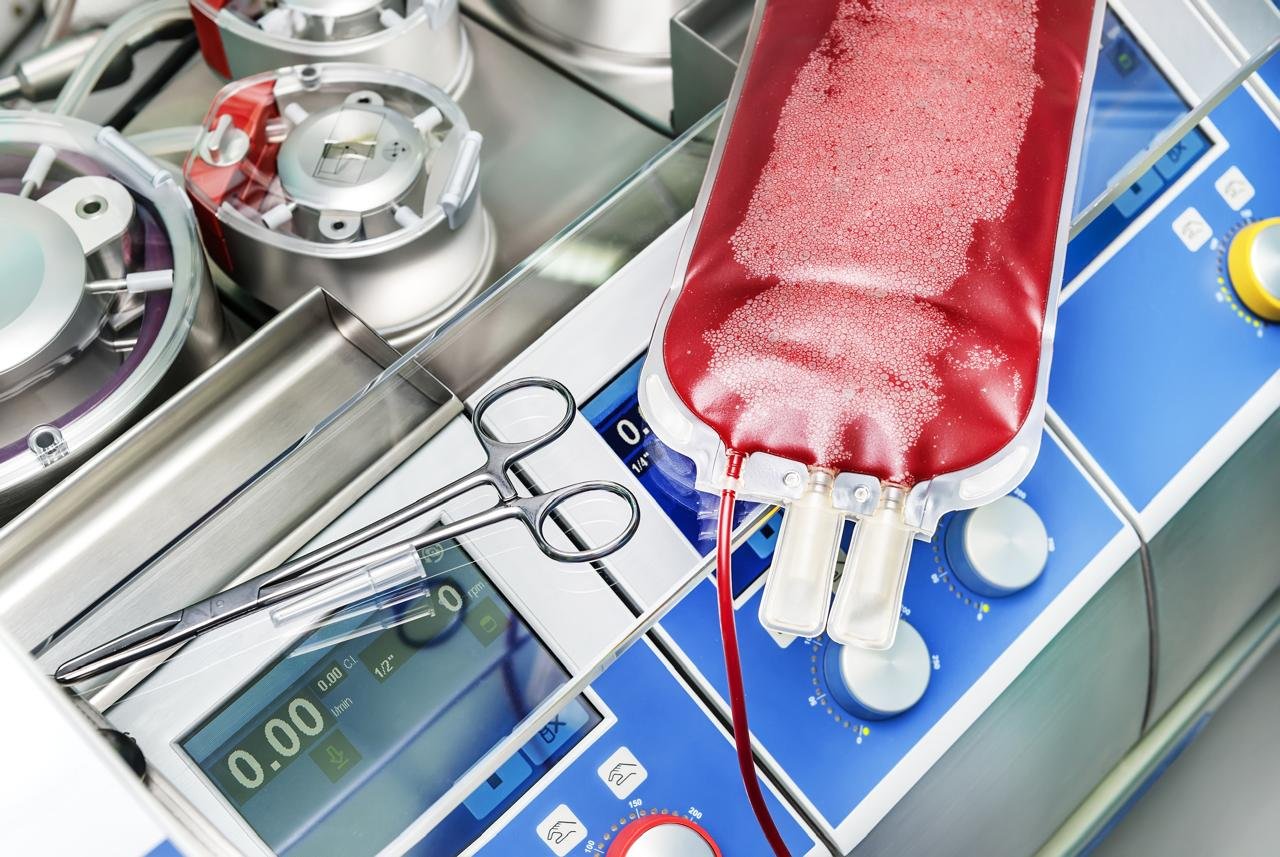 CARDIAC PERFUSION